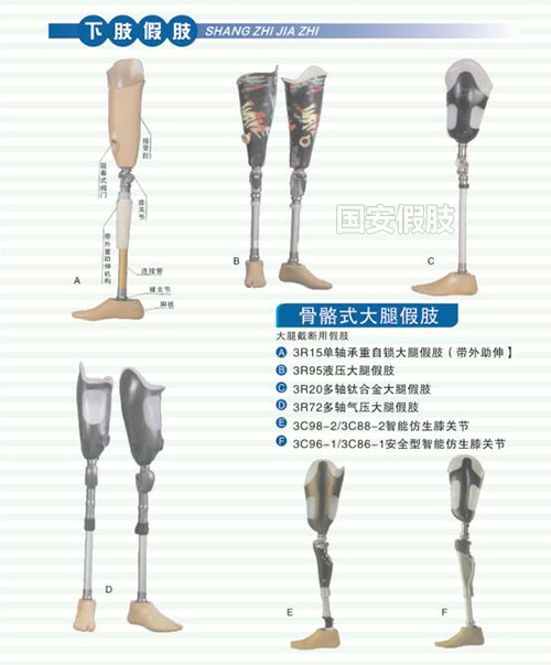 骨骼式大腿假肢