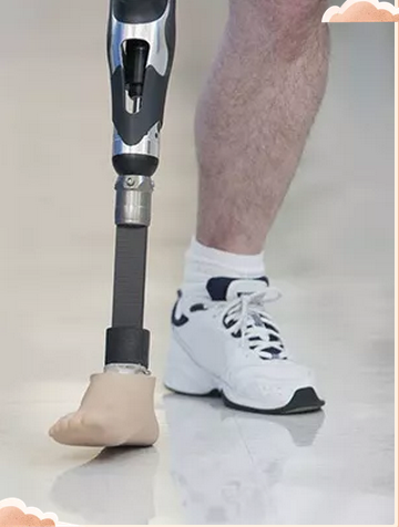 怎么才能正确地穿戴大腿假肢呢？