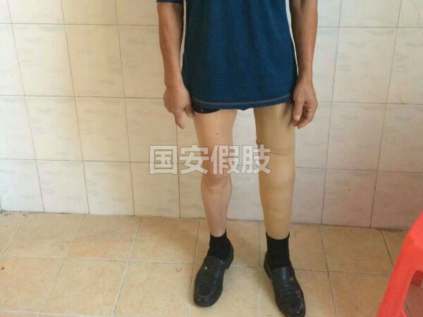 长沙国安假肢康复用品有限公司,长沙假肢用品,国安假肢康复用品,假肢矫形器,康复器材,假肢配件,矫形器支具